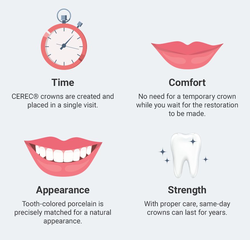 Four icons illustrating CEREC crown benefits: time, comfort, appearance, and strength.
