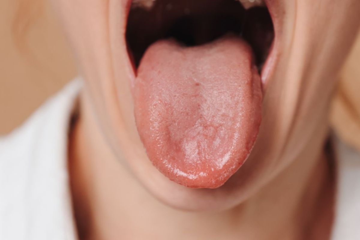 Burned Taste Buds