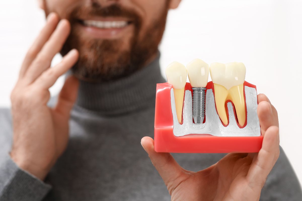 Cleaning Around Dental Implants